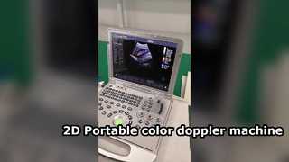 Máquina doppler colorida portátil US15 Plus 2D
