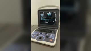 Máquina de ultrassom BR-US22