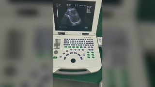 Sistema de diagnóstico de ultrassom para laptop totalmente digital 80element BR-US11
