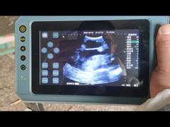 Ultrassom veterinário portátil BR-VET8