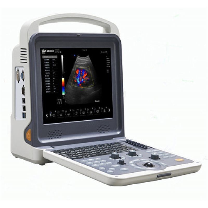 4D Portable color doppler machine