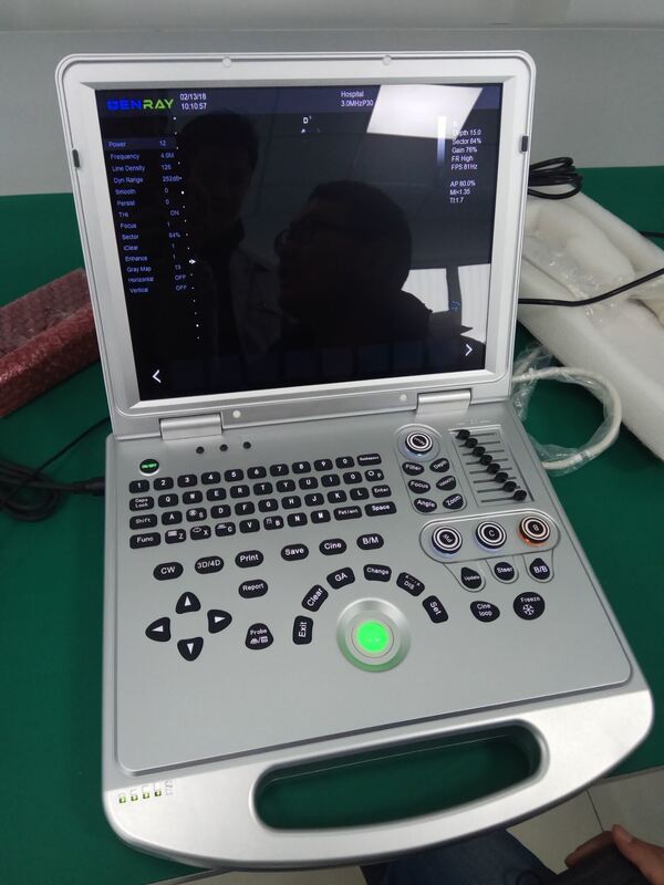 2D Portable color doppler machine