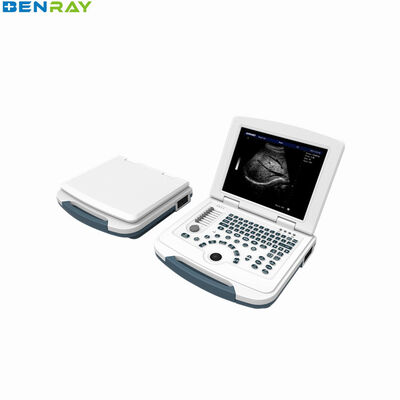 Sistema de diagnóstico de ultrassom para laptop totalmente digital 96 elementos