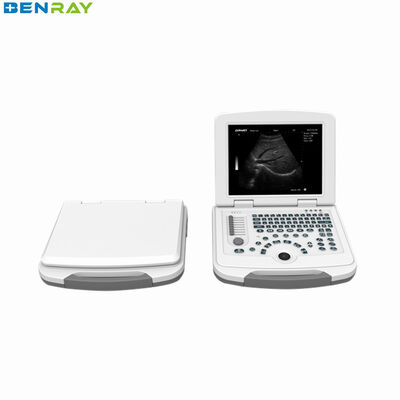 Sistema de diagnóstico de ultrassom para laptop totalmente digital 80element